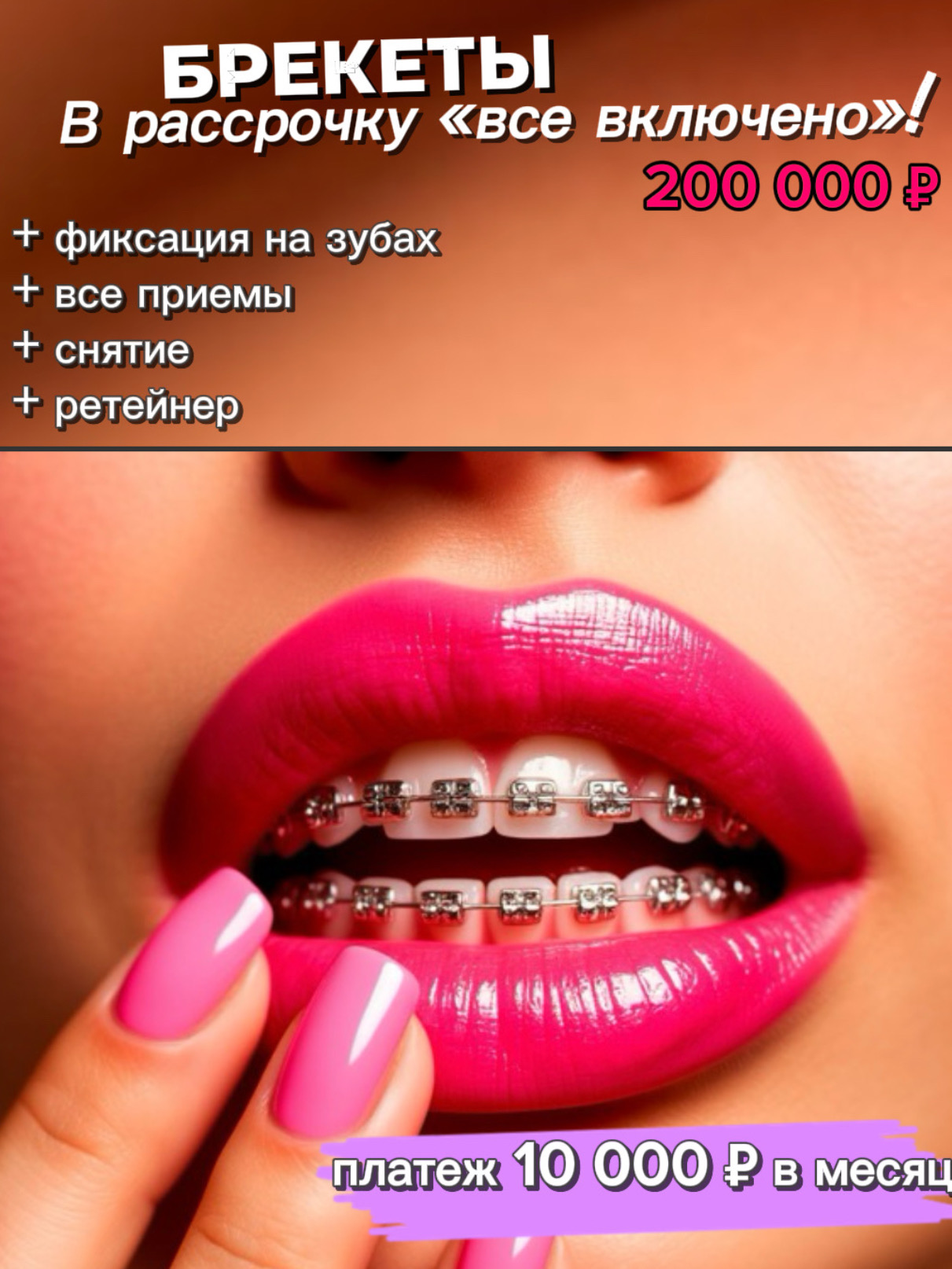 Брекеты в рассрочку